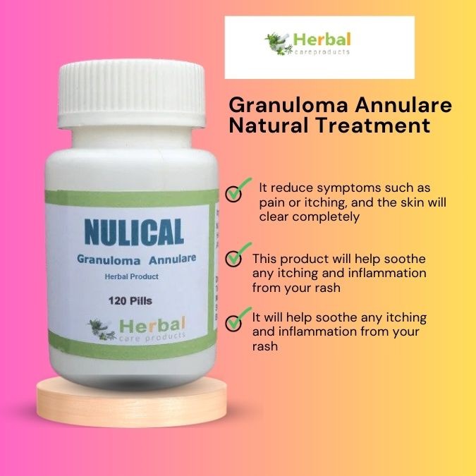 Click image for larger version

Name:	Granuloma-Annulare-Natural-Treatment.jpg
Views:	2
Size:	69.5 KB
ID:	22959